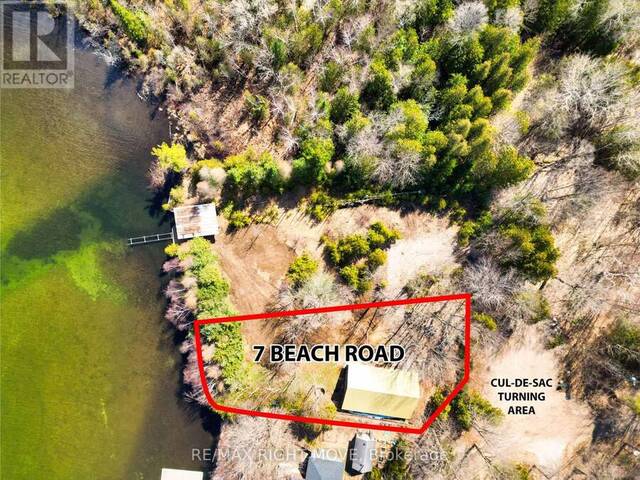 7 BEACH ROAD Oro-Medonte Ontario